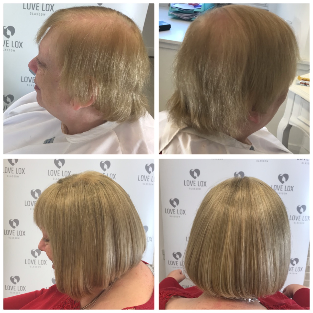 image of lady before and after hair volumising