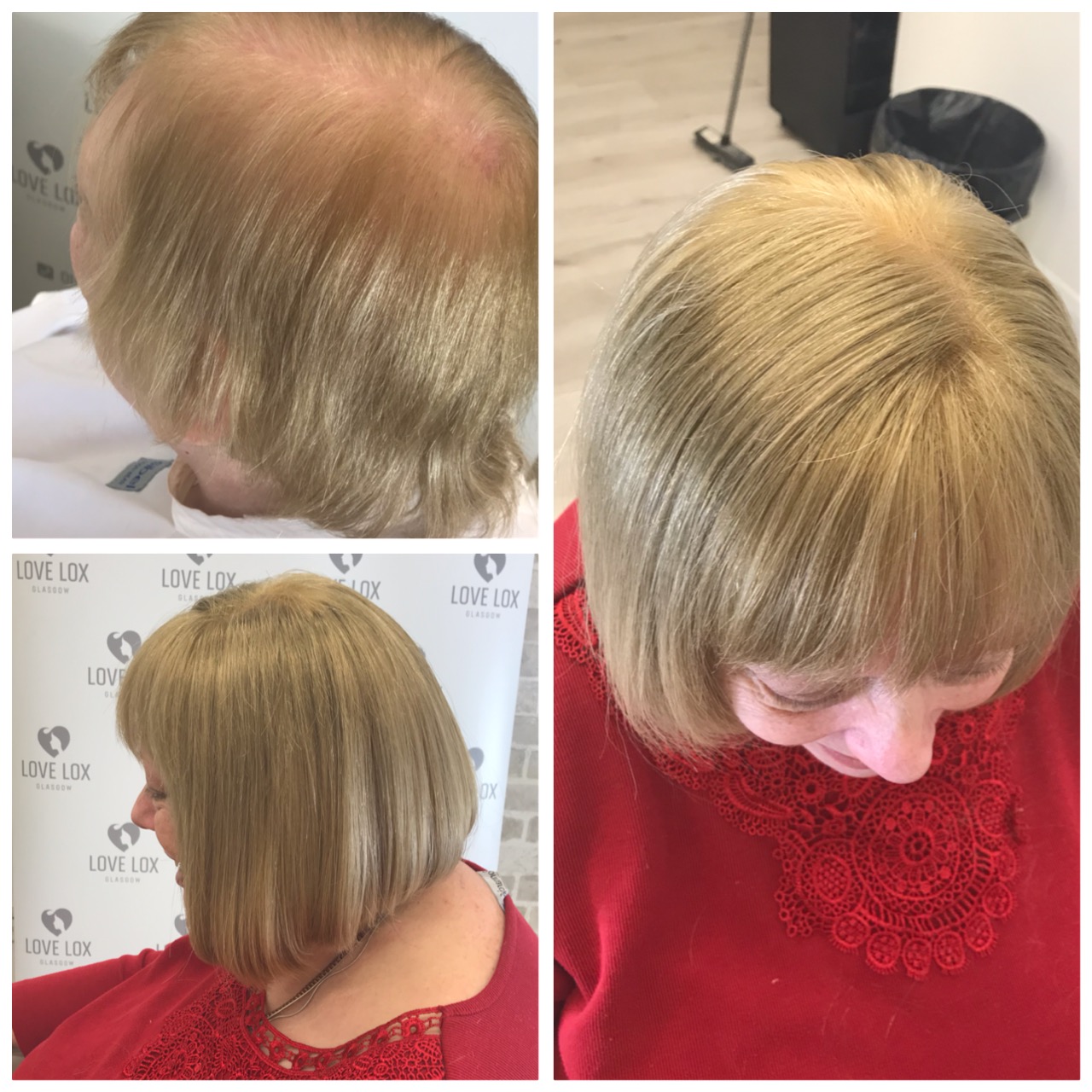 image of lady before and after hair volumising